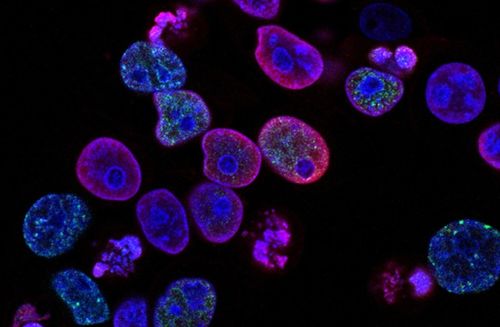 瑞士生物科技公司invasight利用突破性的細胞間蛋白靶點發(fā)現(xiàn)平臺,開發(fā)蛋白質 蛋白質相互作用抑制劑,靶向治療侵襲性癌癥 瑞士創(chuàng)新100強